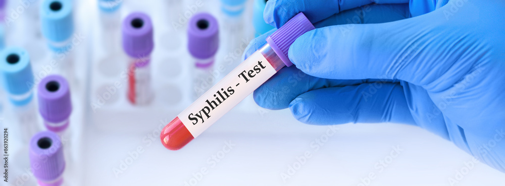 Fototapeta premium Doctor holding a test blood sample tube with Syphilis test on the background of medical test tubes with analyzes.