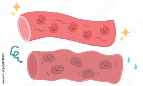 血管のイラスト　サラサラの血・どろどろの血