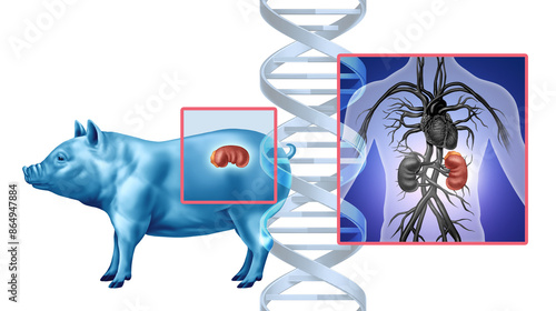 Quadro su tela Pig Kidney Transplant concept as a genetically modified animal organ transferred to humans as Xenotransplantation technology or Xenogeneic transplantation as bioengineered DNA