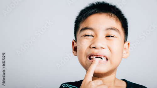 Photos Cute boy widely smiling points to growing molar gap