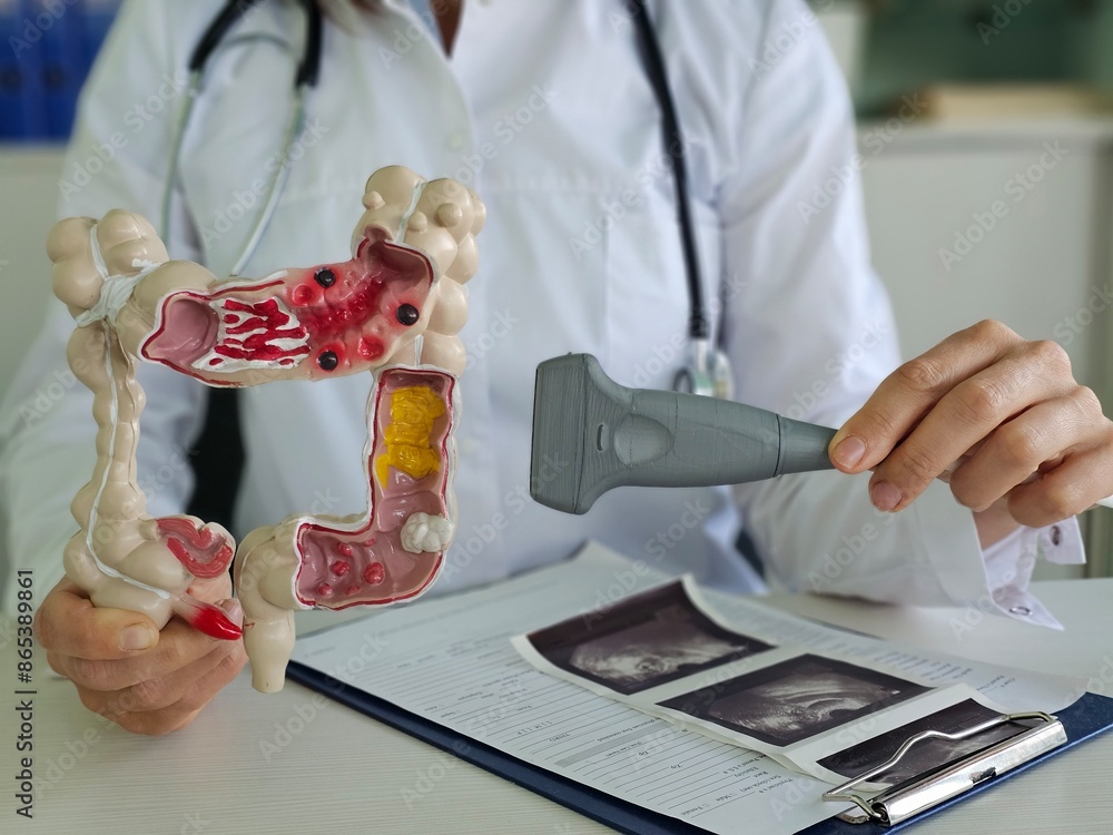 A doctor uses a model of the colon and an ultrasound probe to explain ...