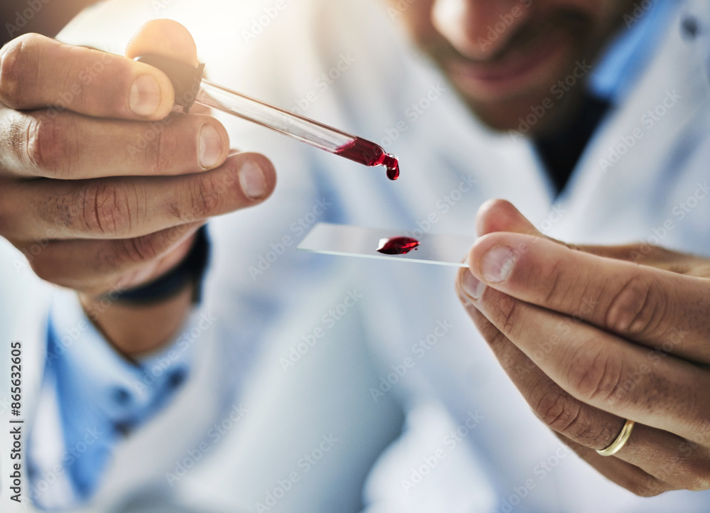Man, scientist and blood sample in lab on glass slide of research analysis, virus test and dna scope investigation. Researcher, genes and biotechnology for pathology, hematology and cell health exam Man, scientist and blood sample in lab on glass slide of research analysis, virus test and dna scope investigation. Researcher, genes and biotechnology for pathology, hematology and cell health exam