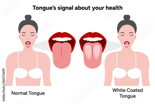 White coated tongue and normal tongue 
