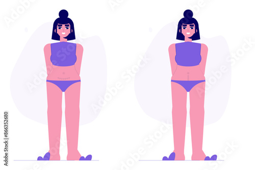 Women with cesarean scar. Stitches after caesarean section, C-section concept. Vector flat illustration isolated white background.