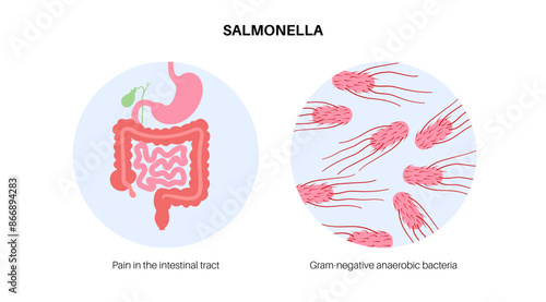 .Salmonella Typhimurium Cells
