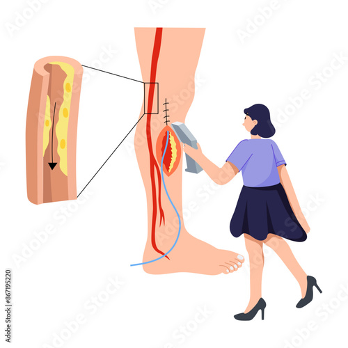 A flat illustration of leg surgery 