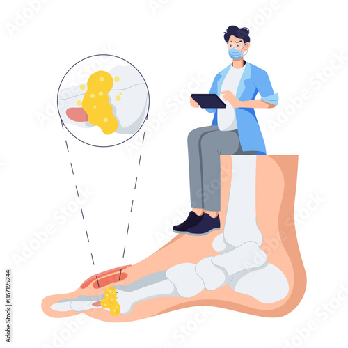 Flat character illustration of gout diagnosis 