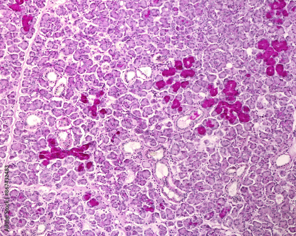 Submandibular gland. PAS stain Submandibular gland. PAS stain