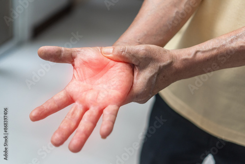 Foto Peripheral Neuropathy pain, Guillain-Barre Syndrome GBS in elderly aged old pati