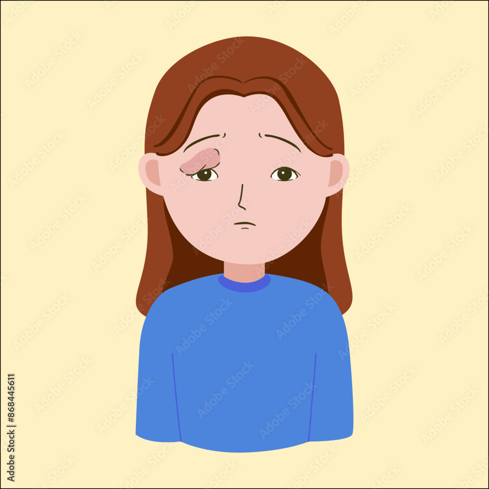 A girl with swollen eye cartoon because of allergy, illustration A girl with swollen eye cartoon because of allergy, illustration