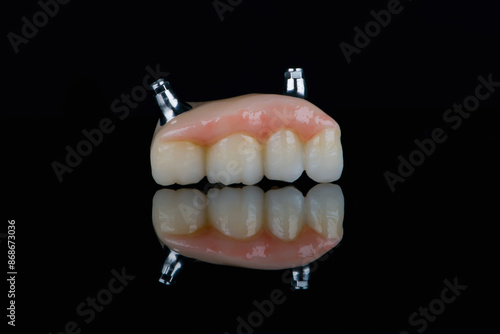 Dental bridge four teeth and artificial gum made of monolithic zirconium for fixation on implants photo