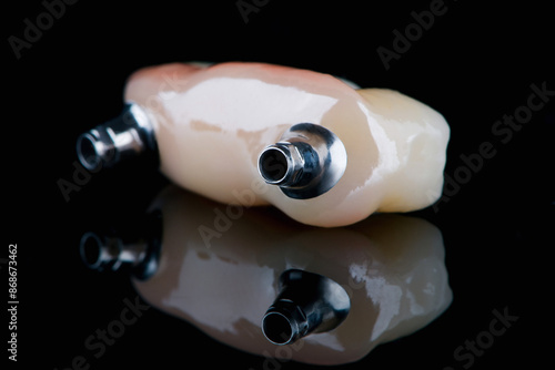 Photos Dental bridge four teeth and artificial gum made of monolithic zirconium for fix