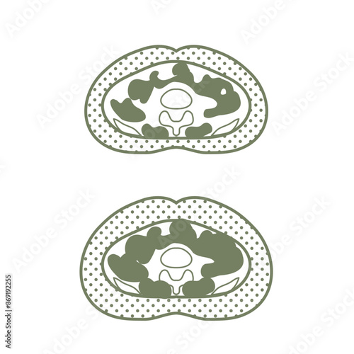 おなかの断面図