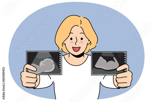 Pregnant woman boasts of ultrasound images of baby in womb of future mother in prenatal period. Pregnant blonde girl smiles and prepares to become mom and give birth to healthy newborn