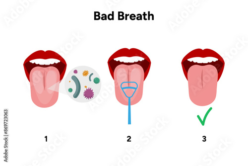 Bacterial in the mouth with tongue cleaner