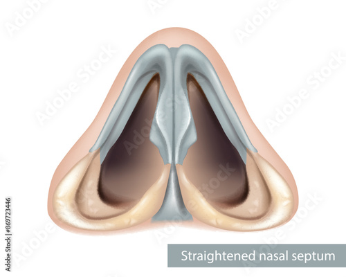 Nasal septum anatomy. Nose, nasal cavity. Inferior view