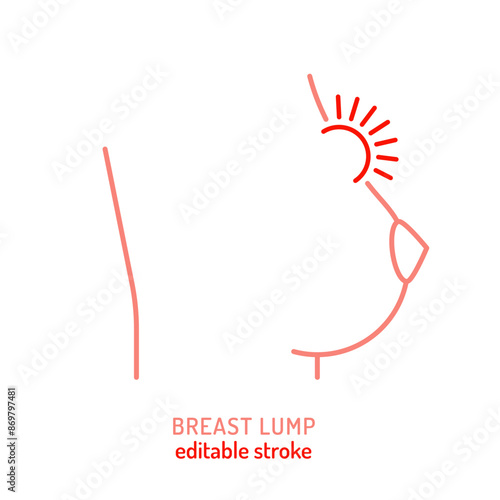 Breast lump outline icon, pictogram. Abnormal thickening, swelling sign in line style.