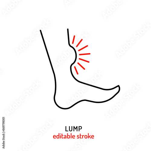 Lump outline icon, pictogram. Abnormal thickening, swelling sign in line style.