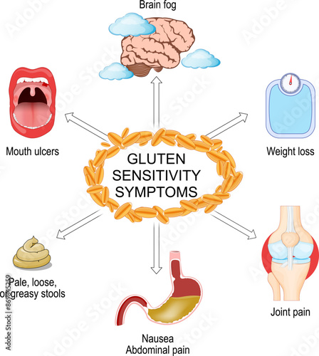 Gluten sensitivity symptoms. Gluten intolerance. Celiac disease