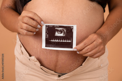 Pregnant belly human pregnancy pre natal care health care gynecology child bearing