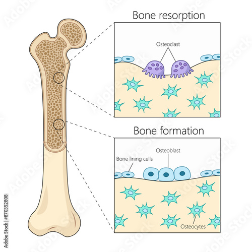 bone resorption and formation processes, highlighting osteoclast and osteoblast activity in bone tissue diagram hand drawn schematic vector illustration. Medical science educational illustration