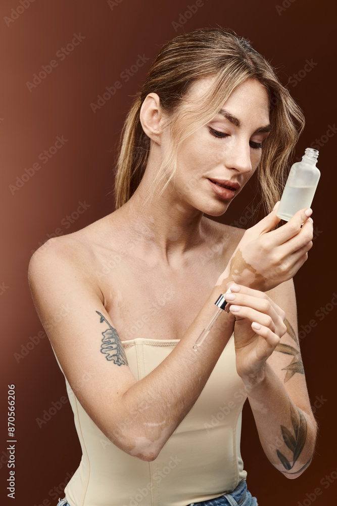 Obraz premium A young woman with vitiligo holds a skincare product and applies it to her arm.