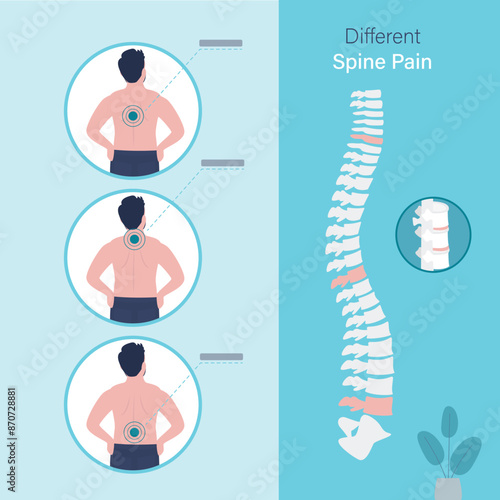 Back pain and body posture infographics with anatomical illustrations. Diagnosis and treatment. Medical scheme with pain vertebral body and damaged with injury spinal cord.