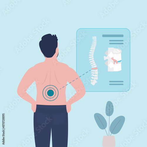 Unhappy man has low back pain and sciatica from herniated disc. Medical diagram about trapped nerves make patients chronic pain in back and paralysis. Rear view.
