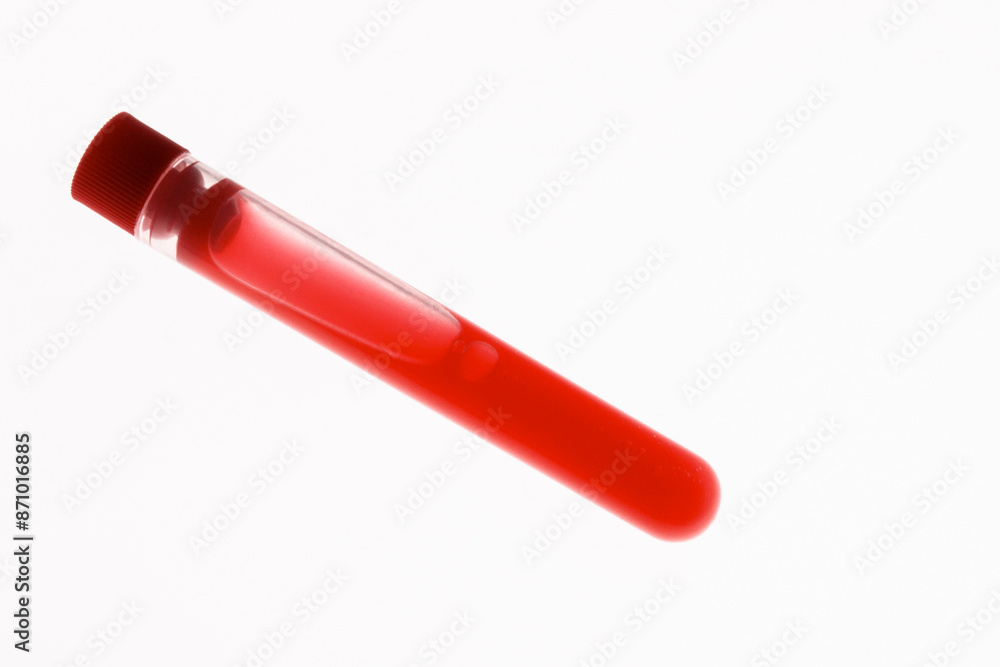 Laboratory test tube with lid and blood samples on light background Laboratory test tube with lid and blood samples on light background