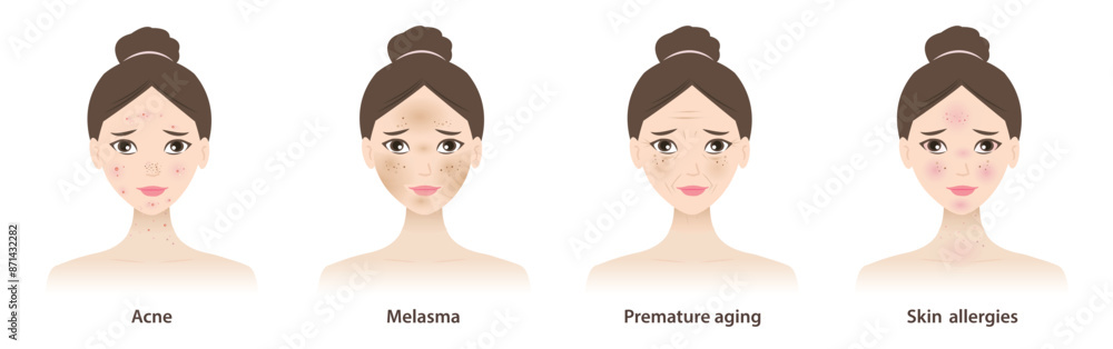 The cute women with skin problems vector illustration isolated on white background. Types of skin problems, acne, pimple, hyperpigmentation, melasma, premature aging, wrinkles and skin allergies. The cute women with skin problems vector illustration isolated on white background. Types of skin problems, acne, pimple, hyperpigmentation, melasma, premature aging, wrinkles and skin allergies.