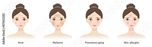 The cute women with skin problems vector illustration isolated on white background. Types of skin problems, acne, pimple, hyperpigmentation, melasma, premature aging, wrinkles and skin allergies.