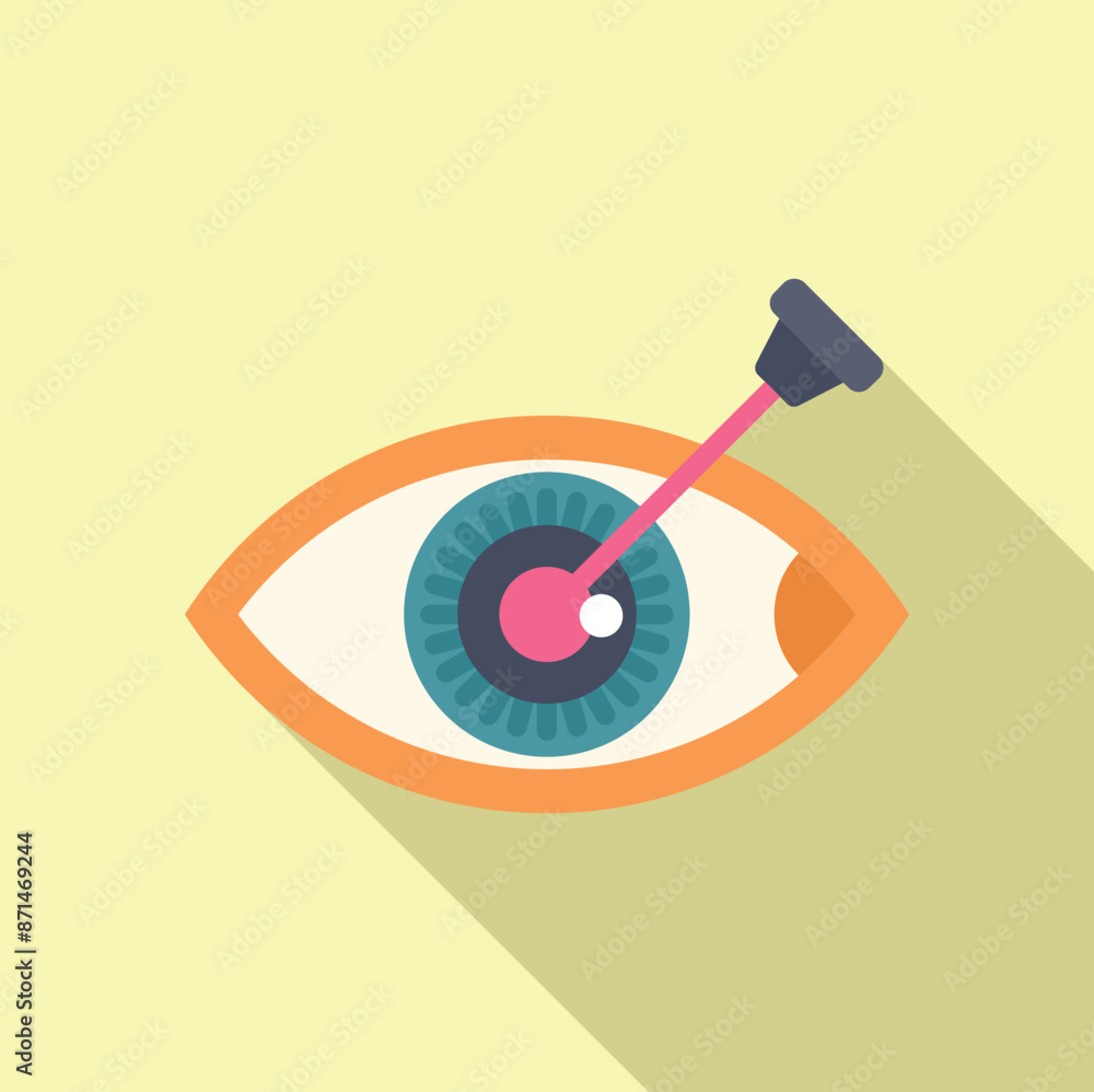 Laser surgery correcting vision by pointing a light beam on a human eye Laser surgery correcting vision by pointing a light beam on a human eye