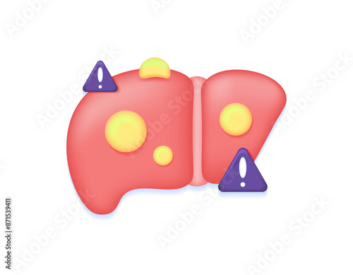 fatty liver disease concept. health problems with the liver organ. illustration of a liver containing or covered with a lot of fat. symbol or icon. minimalist 3d style design. graphic elements
