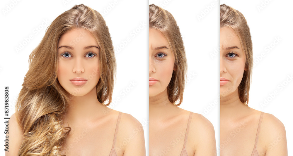 Effects of ageing,Frown/scowl lines ,Nasolabial folds,Neck ,Under eye circles,neck lines. Plastic Surgery Results Effects of ageing,Frown/scowl lines ,Nasolabial folds,Neck ,Under eye circles,neck lines. Plastic Surgery Results