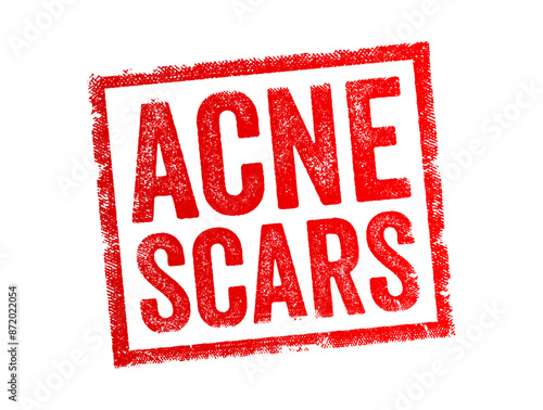 Acne Scars - the marks left on the skin after acne lesions have healed, text concept stamp
