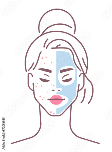 Face divided into acne problem skin area and cosmetic gel mask. Linear portrait of beautiful girl vector illustration