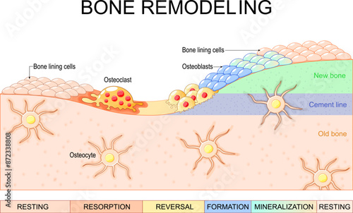 Bone remodeling process. Close-up of Osteoblasts, Osteoclast, Osteocytes