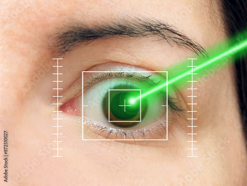 Картината върху платно Close-up of brown eye with digital guides treated with green argon laser beam surgery process for retinal vision disease, diabetic retinopathy, retinovascular visual illness problems and glaucoma