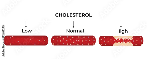 Cholesterol Level Science Design Vector Illustration Diagram