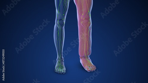 Medical animation depicting limb lymphedema