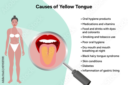 Causes of yellow tongue