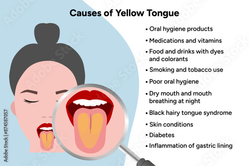 Causes of yellow tongue