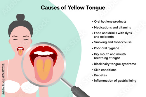 Causes of yellow tongue
