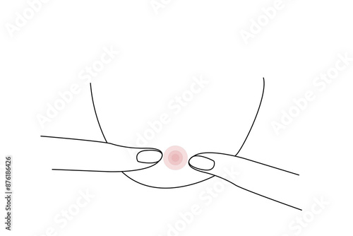 human person acne face effect skin health one line art design vector