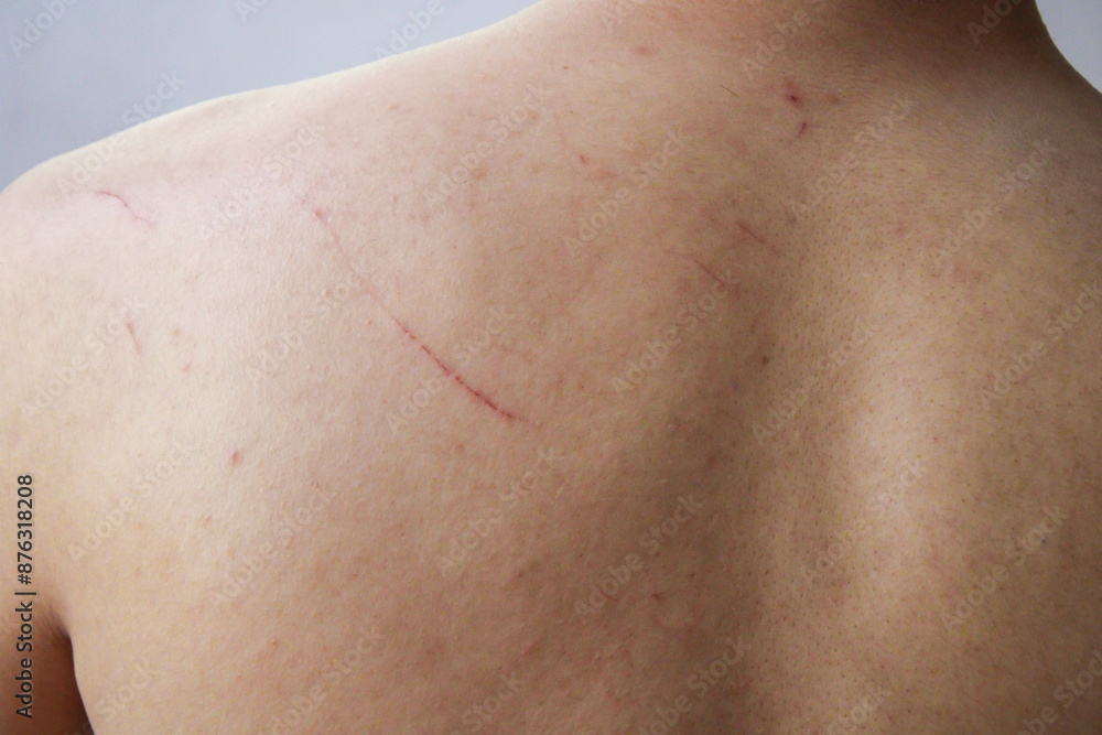 Wounds. Scratches on the skin. Wounds. Scratches on the skin.