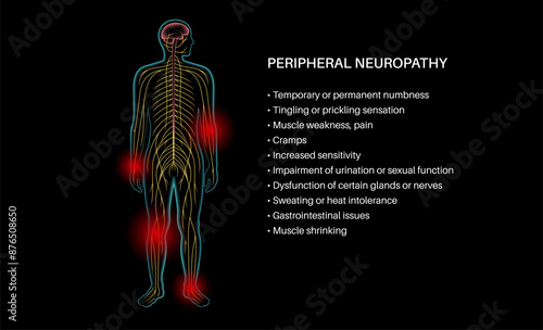 Peripheral neuropathy medical poster