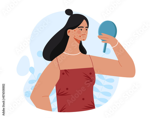 Woman with acne. Young girl looking in mirror. Skin diseases and illness. Dermatology and epidermis, cosmetology. Person with oily face. Flat vector illustration isolated on white background