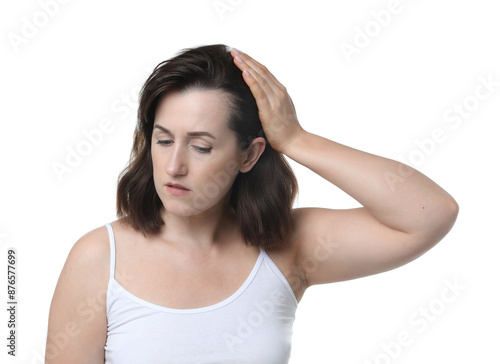 Woman with hair loss problem on white background