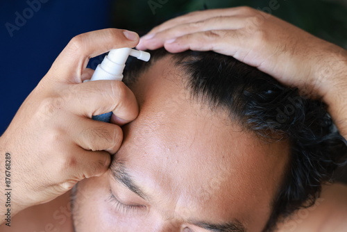 Asian men use serum spray to maintain strong hair and prevent breakage. Man with worry and touching on his head to show a bald head. Hair root nourishment. concept of healthcare, treat, medicine.