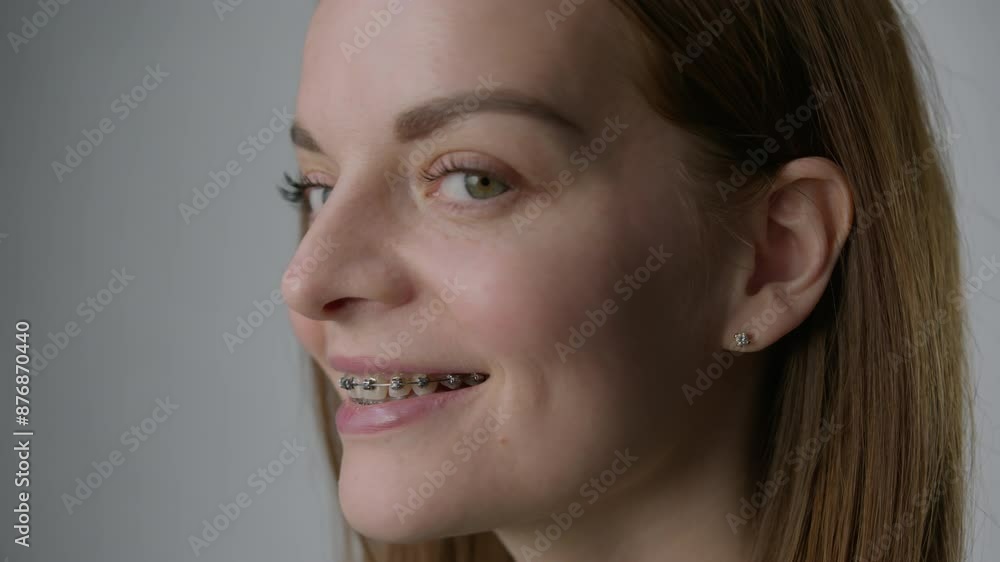 A red-haired woman with braces turns to the camera and smiles A red-haired woman with braces turns to the camera and smiles